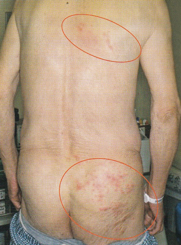 退院しました⌒‐⌒- 花好きグランマの独り言