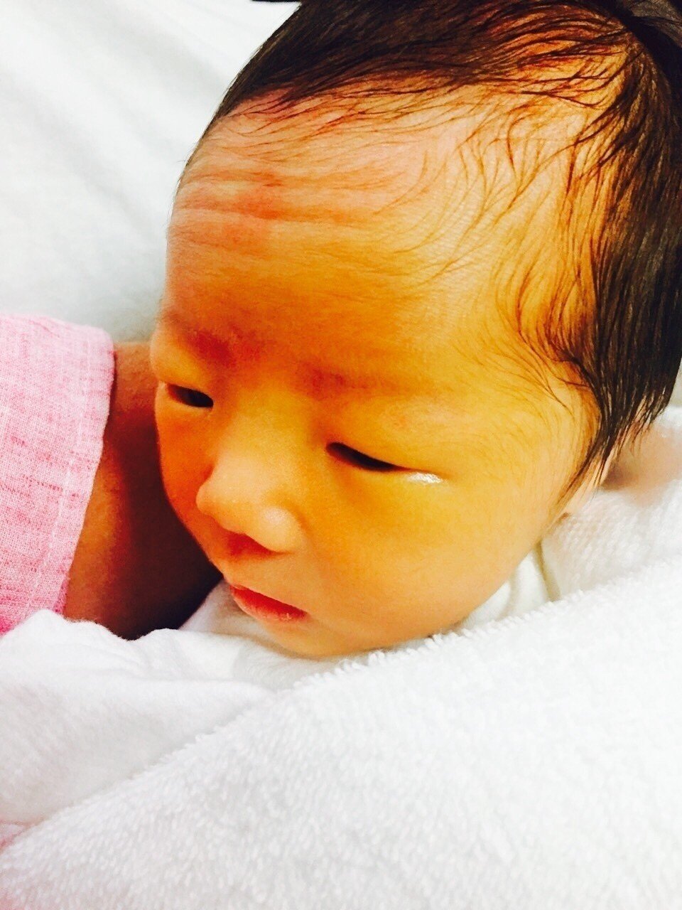 新生児黄疸は危険なのか？原因と数値の読み方、光線治療の基準値MEDLEY メドレー