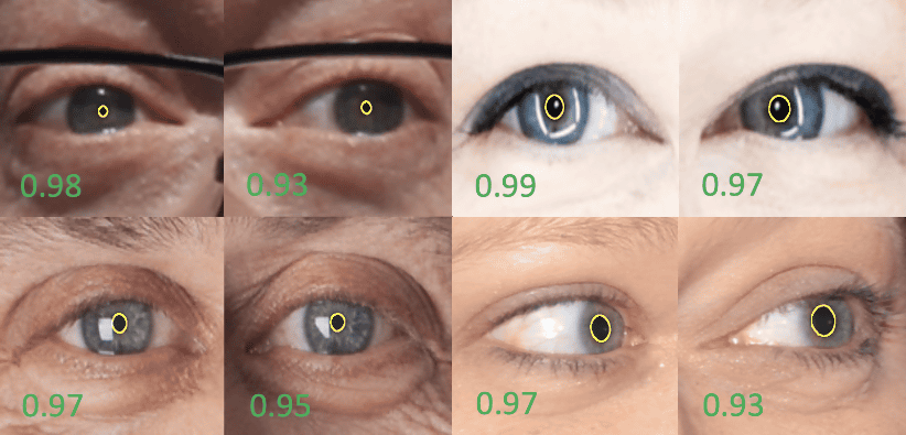 ハート型の瞳？にしわき眼科クリニック。 - 楽天ブログ