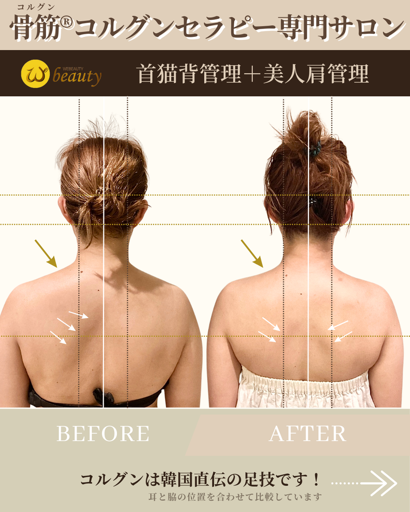 ストレートネック 前橋市の整骨院なら実績多数の前橋アイメディカル鍼灸整骨院腰痛・不妊・むちうち