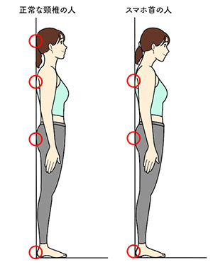 猫背・スマホ首」を本気で直したい人へ！１回10秒ストレッチで背中が別人