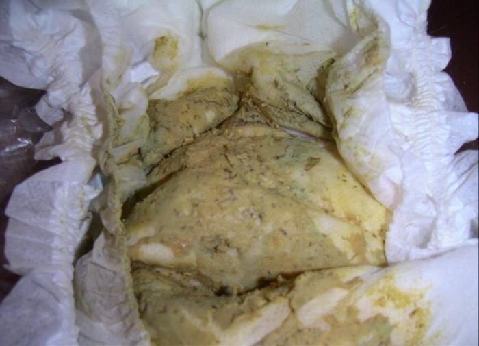 赤ちゃんの便、色をチェック 黒や白、病気のケースも - 日本経済新聞