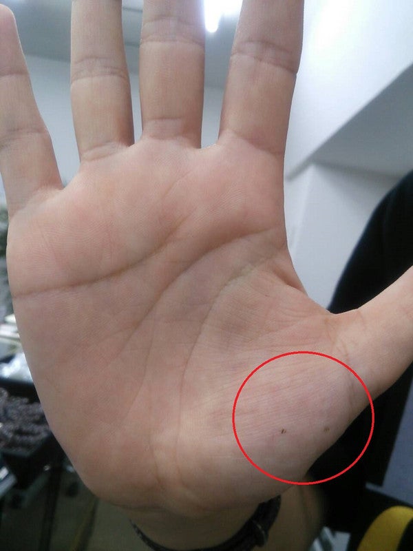 ほくろ占い 手相 手のひらのホクロにより恋愛や結婚に対する影響が・。Love MeDo ラブちゃん オフィシャルブログ「黄金のリンゴ」Powered by Ameba