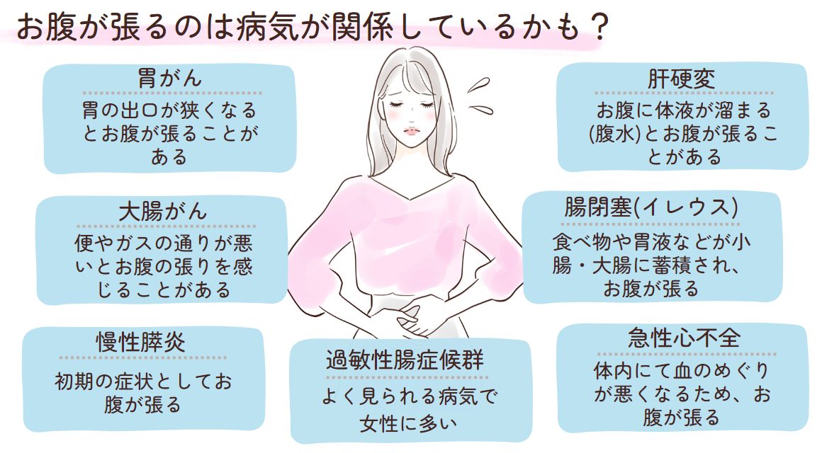 専門医が解説 腹部のはり・もたれ・違和感の原因と治療巣鴨駅前胃腸内科クリニック