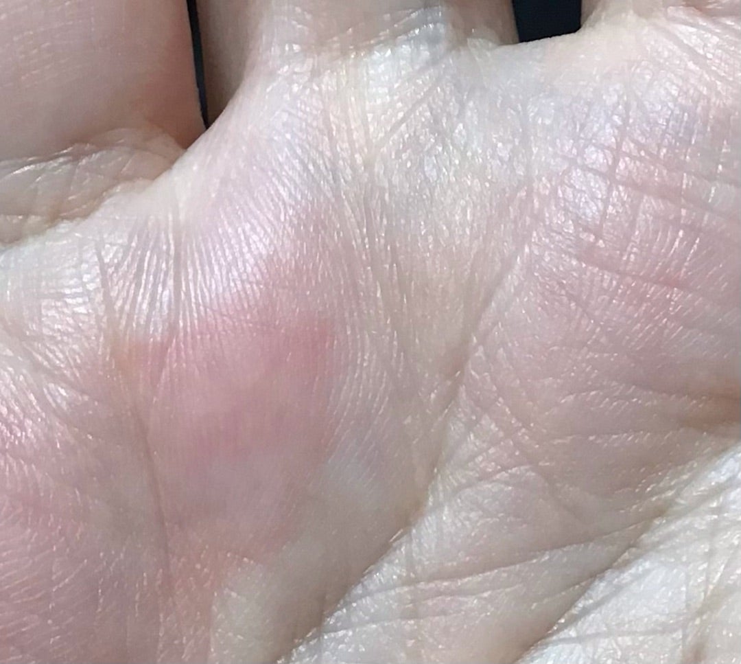 あったらヤバイ手相！最悪の13線・最高の5線 - zired