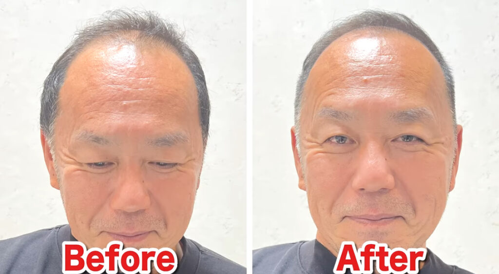 美容師監修 薄毛のメンズにおすすめの髪型15選！スタイリングのコツも伝授 - OZmall