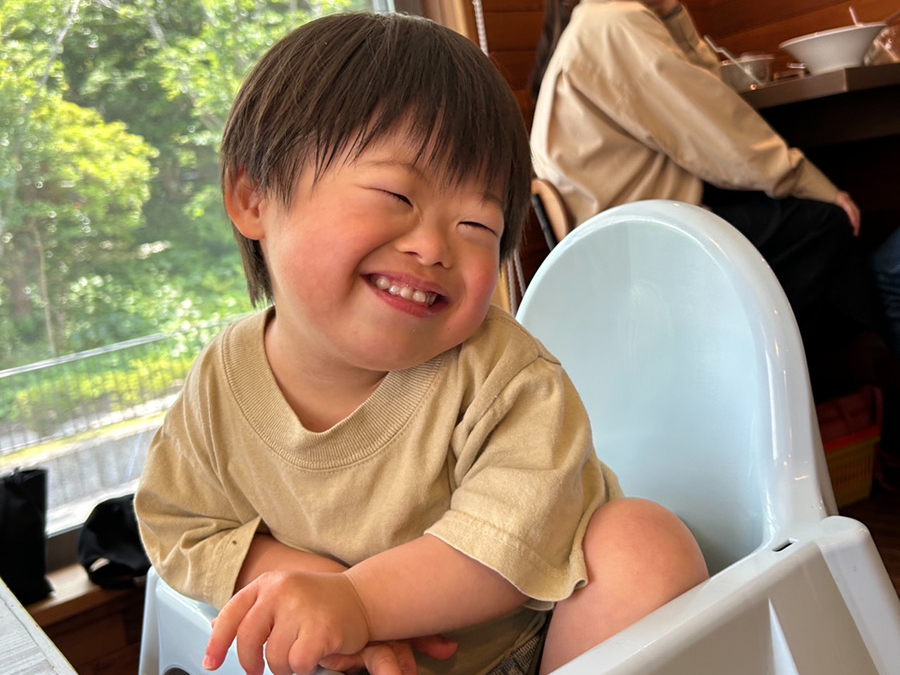 ダウン症の赤ちゃんの特徴 〜大規模な研究から分かったこと〜うこうこまーく