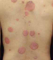 フローチャートで解決！皮膚病診断医療情報研究所 DVD教材ストア