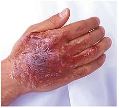 傷メイク話題沸騰中のコスメ〜真似したいメイク方法の口コミが67件！デパコスからプチプラまでLIPS