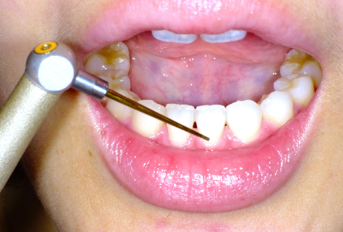 診療案内Yamazaki Dental Clinic