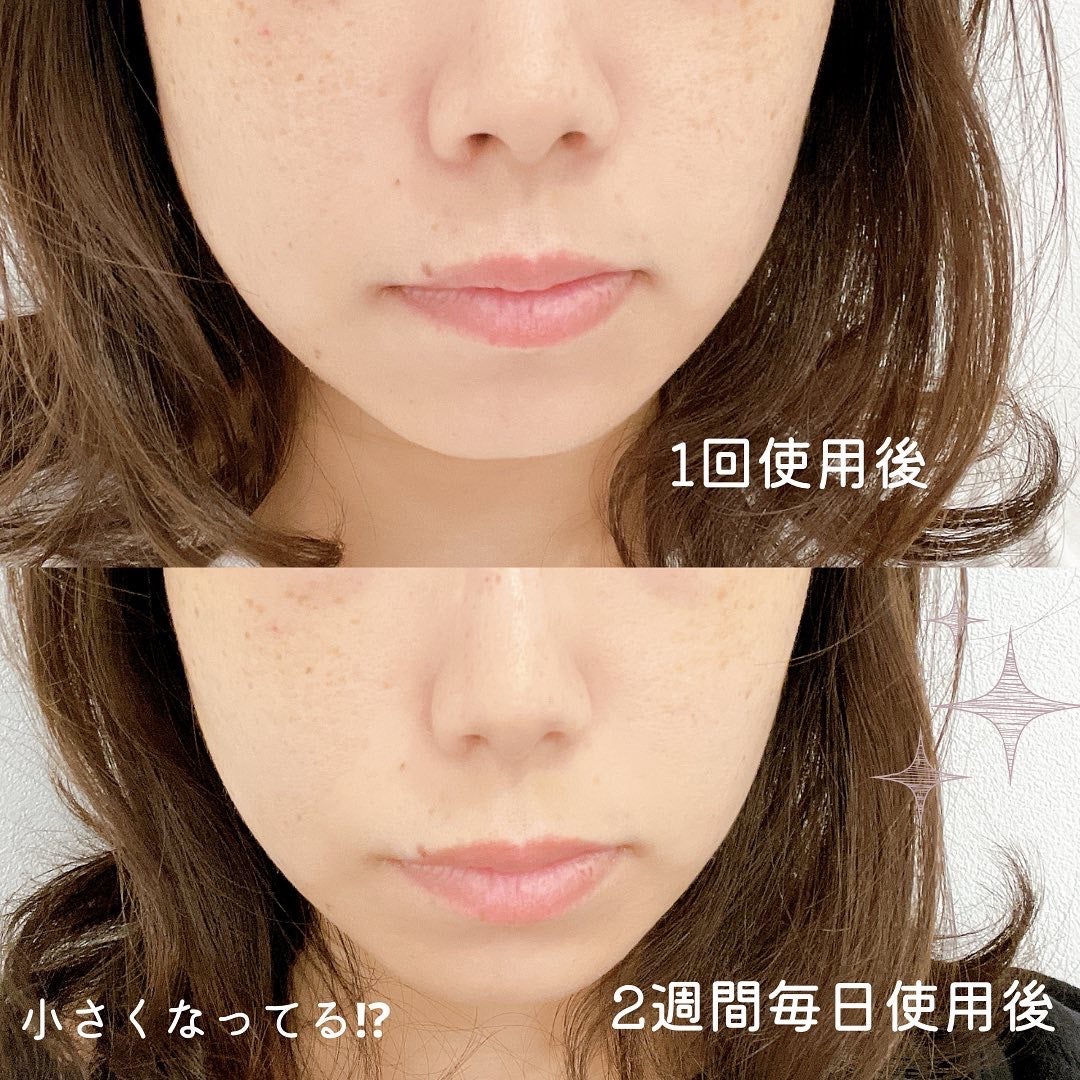 楽天市場楽天1位 ヒルナンデス!で紹介! No.1 鼻専用美顔器フォーネスPRO新型 LUXCEAR ノーズクリップ 鼻 高く EMS 鼻矯正Eライン 鼻クリップ 鼻プチ 鼻矯正 美鼻 ノーズアップピン 鼻高 鼻筋ピン ホームエステ ルクセア メーカー正規品 :LUXCEARオンラインショップ