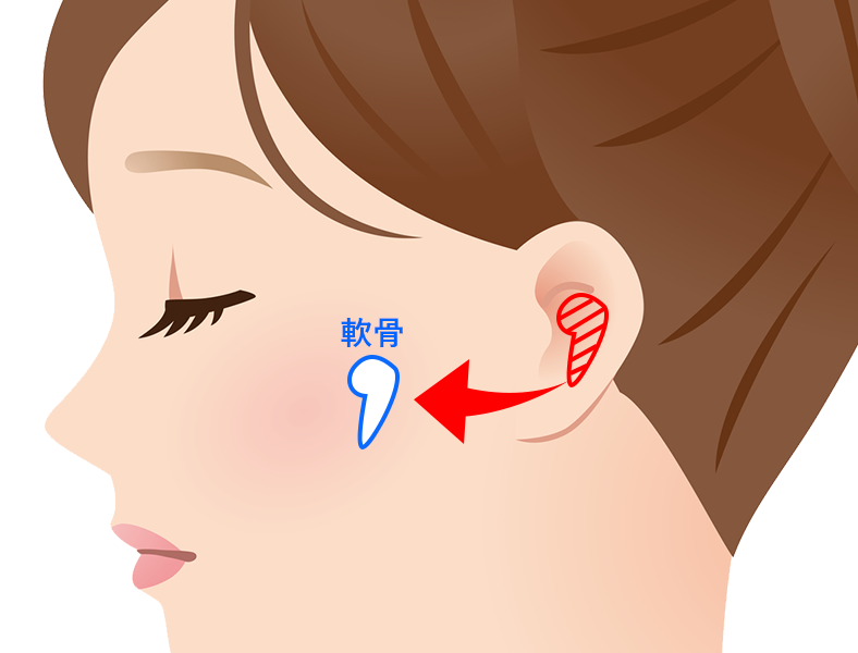 ピアス 折れ耳横浜市鶴見の形成・美容外科 エムズクリニック