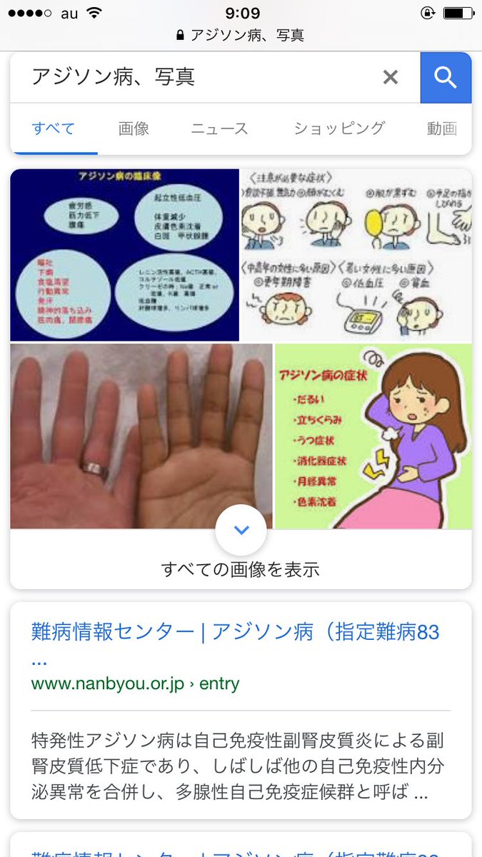 内分泌疾患中央林間糖尿病・甲状腺クリニック中央林間駅6分 甲状腺