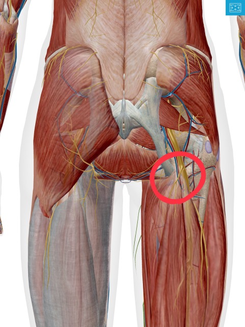 太ももの痛み大樹整骨院・守山本院