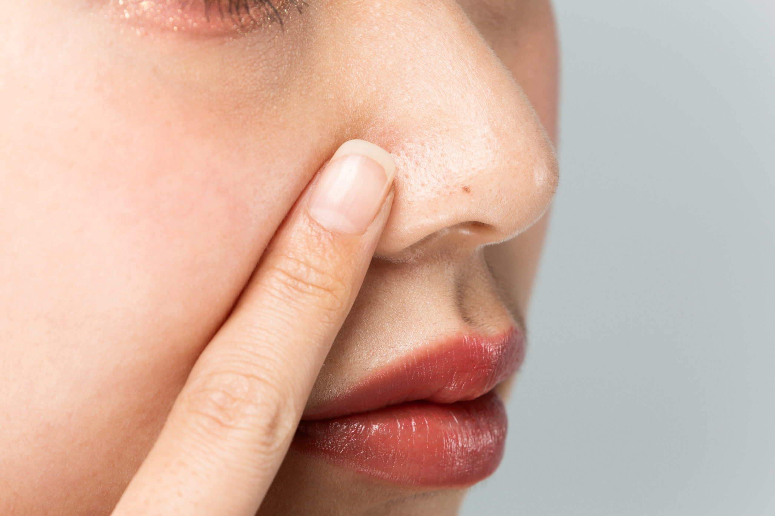 鼻の下にニキビがよくできるのはなぜ？原因や早く治す方法を解説ANS. magazine