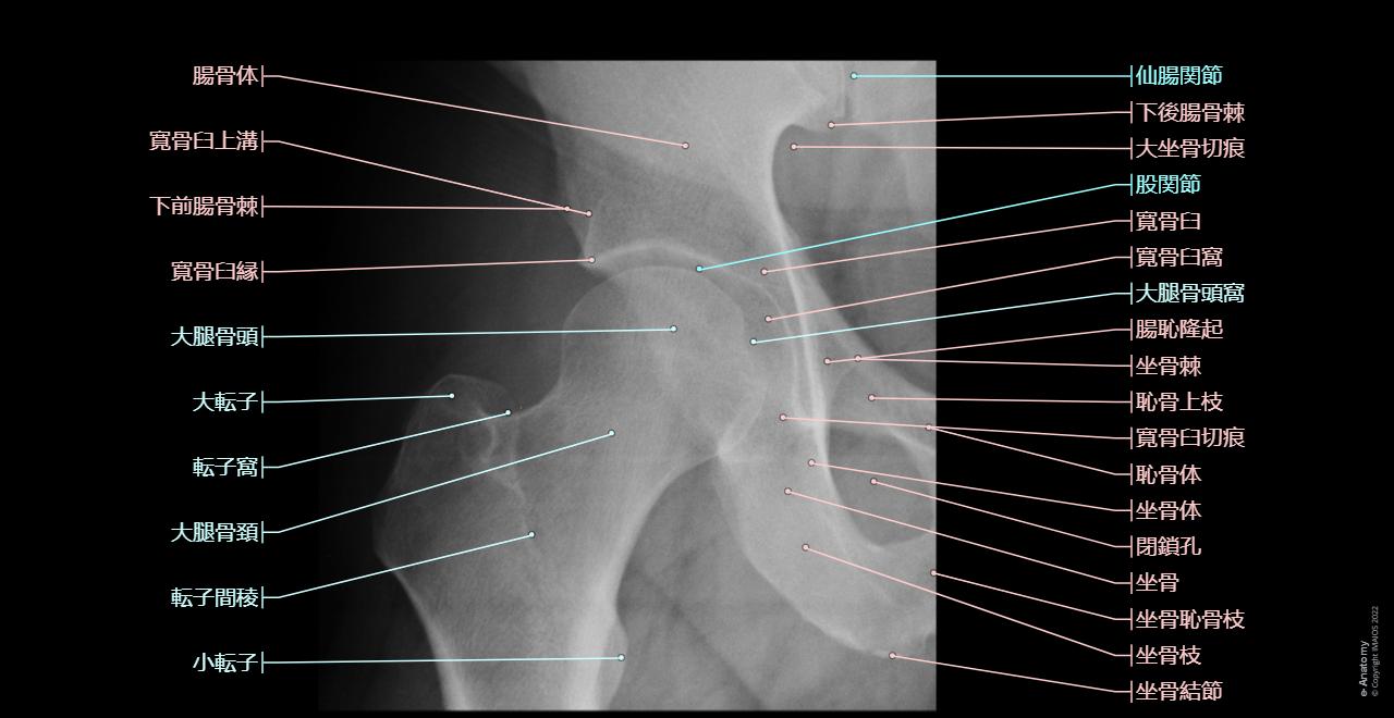 レントゲン検査で原因の分からなかった関節痛って大丈夫？MEDLEYニュース
