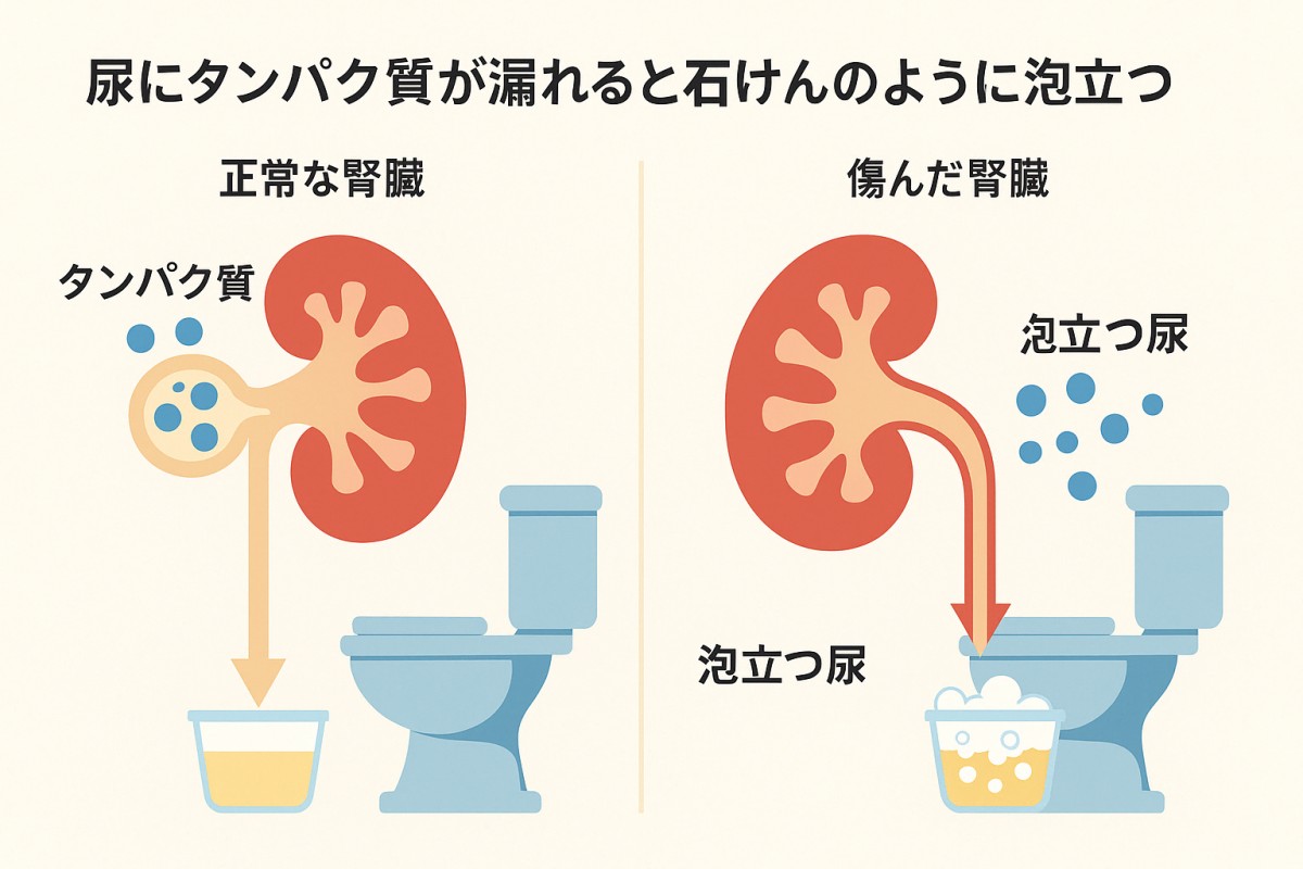 尿で病気がわかるの？ヨミドクター 読売新聞