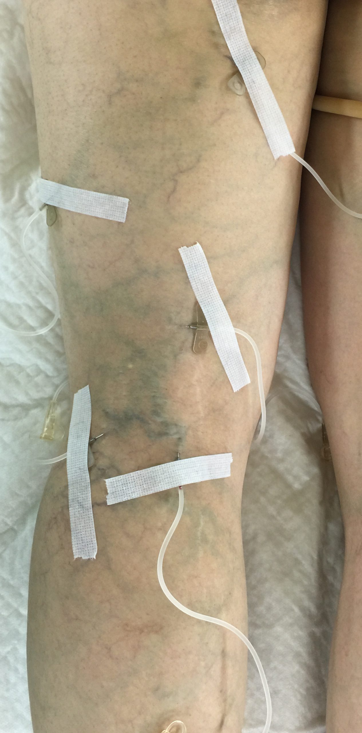 妊娠中の浮腫 むくみ はなぜ起こる？メカニズムやママと赤ちゃんの影響について 医師監修 ガーデンヒルズウィメンズクリニック福岡市中央区の産婦人科