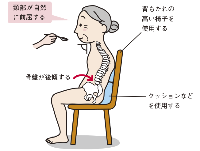 褥瘡のせいでムセる？ 慢性期の摂食嚥下リハビリテーション② - NsPace ナースペース -家で「看る」あなたを支える