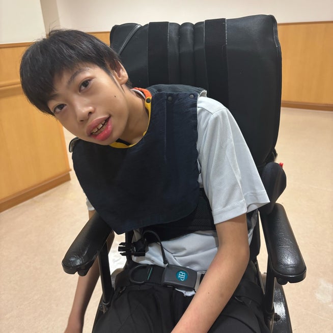 クルーゾン症候群・アペール症候群・ファイファー症候群など「頭蓋骨縫合早期癒合症」による頭蓋－顔面変形の治療受け口などの顎変形症、あごえら・小顔矯正・性同一性障害の顔面輪郭、鼻整形、顔面変形、睡眠時無呼吸症候群の形成美容外科専門治療：東京警察病院形成