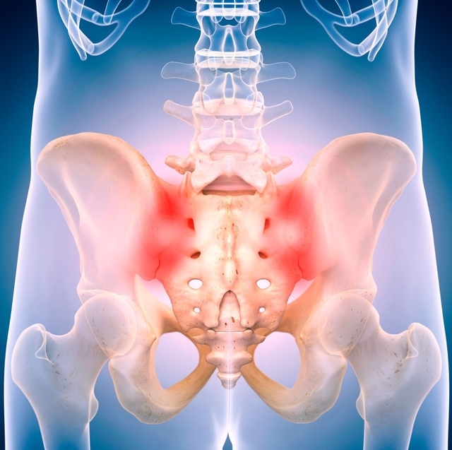 骨盤の痛みとはどのような症状ですか？ 骨盤の痛み