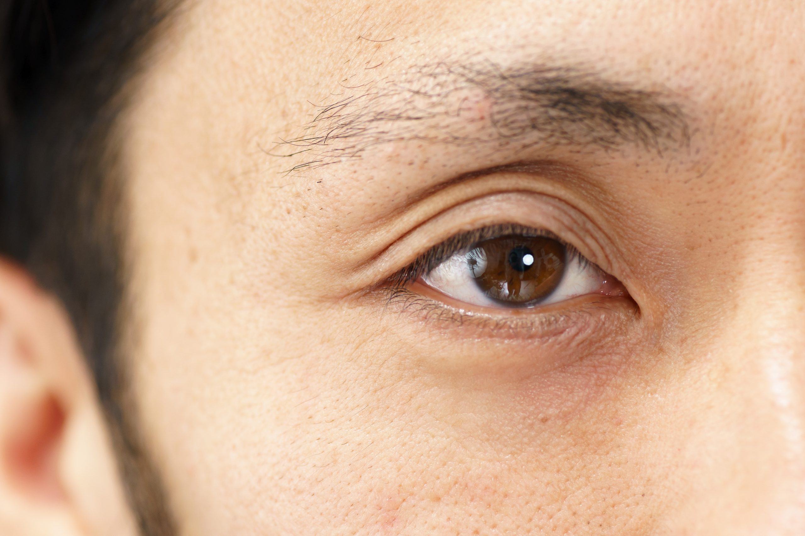 目の充血はストレス！？目が赤い原因と考えられる病気福地眼科