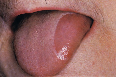 中核症状ー失認ー脳疾患を知る桑名眼科脳神経クリニック