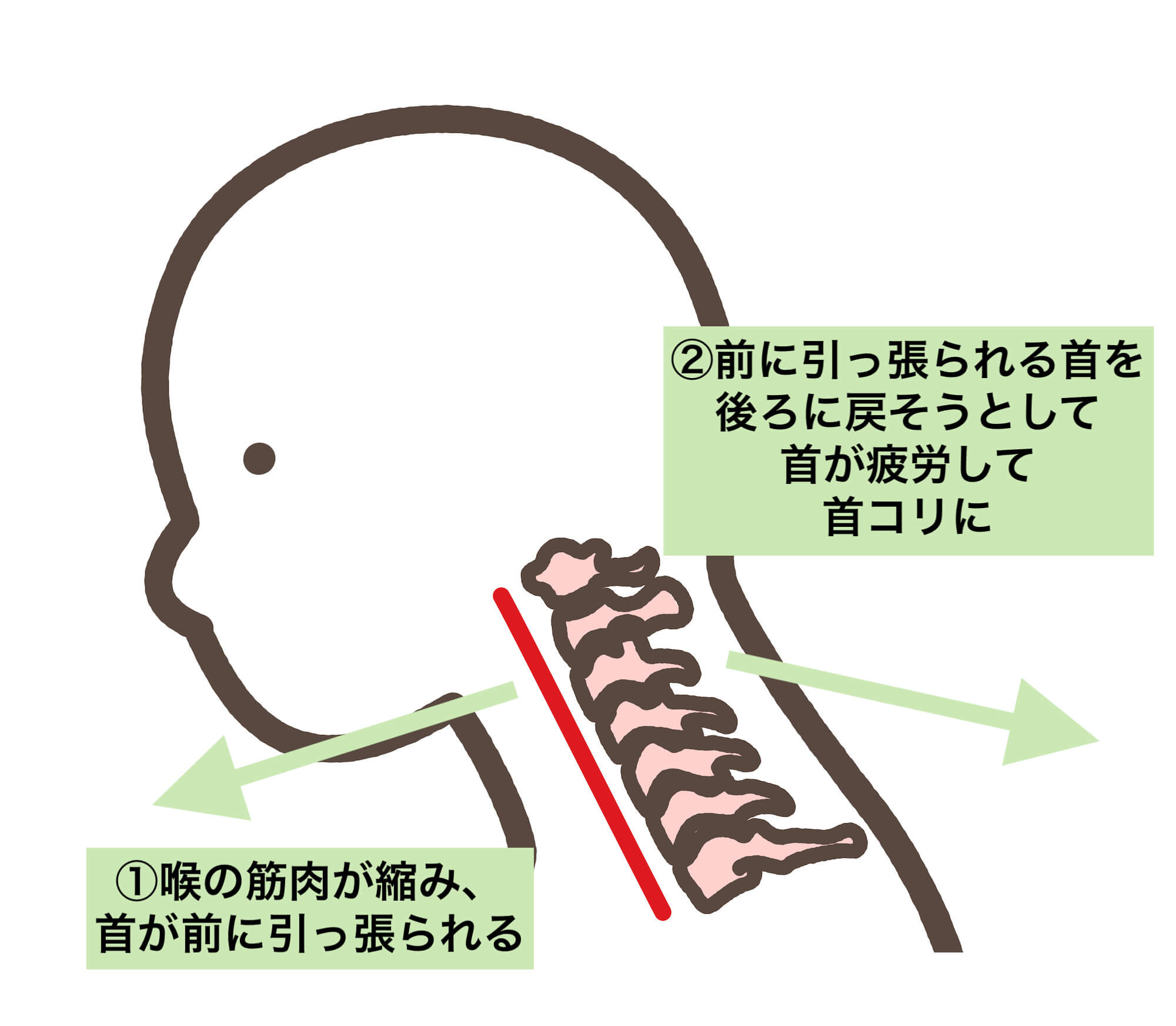 首こりは肩こりに影響する？テレワークでのストレートネック スマホ首 や首猫背に注意！原因と改善方法EXGEL SEATING LABエクスジェル シーティングラボ株式会社 加地