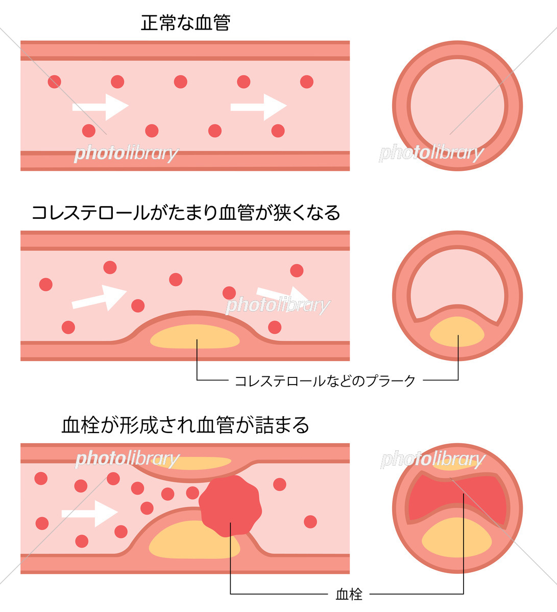 柏市で動脈硬化の治療なら柏駅前内科・皮ふ科
