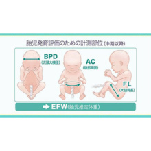 19世紀に発掘されたミイラが妊婦だったと判明！ 「胎児」は酸化して”ピクルス状態”に - ナゾロジ