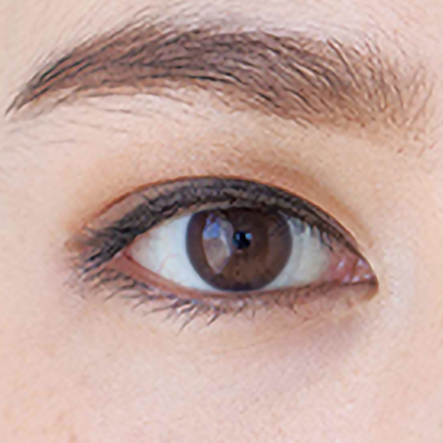 蒙古ひだ・目頭切開プレミアム二重・目元整形なら湘南美容クリニック 公式