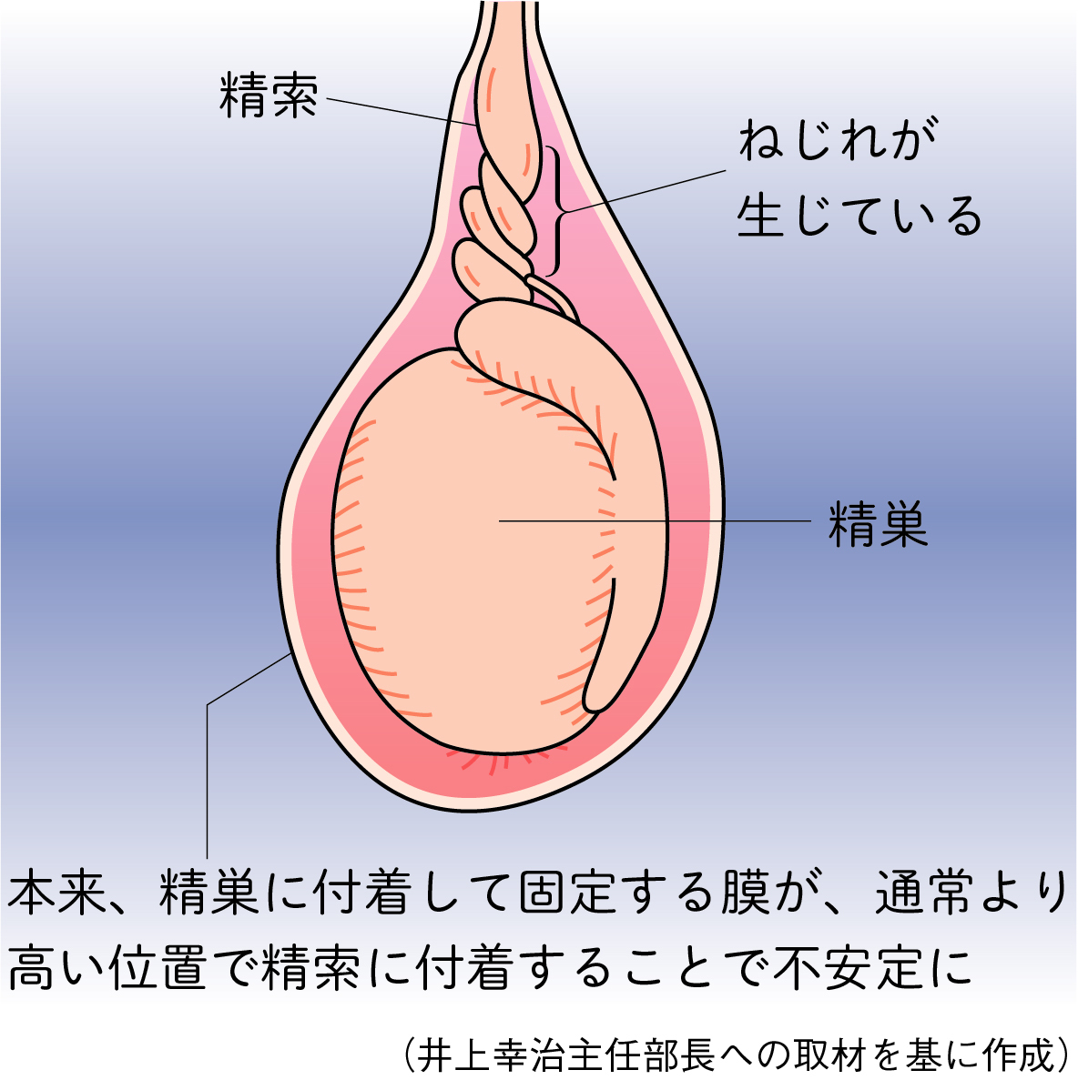停留精巣と移動性精巣 - 23. 小児の健康上の問題 - MSDマニュアル家庭版