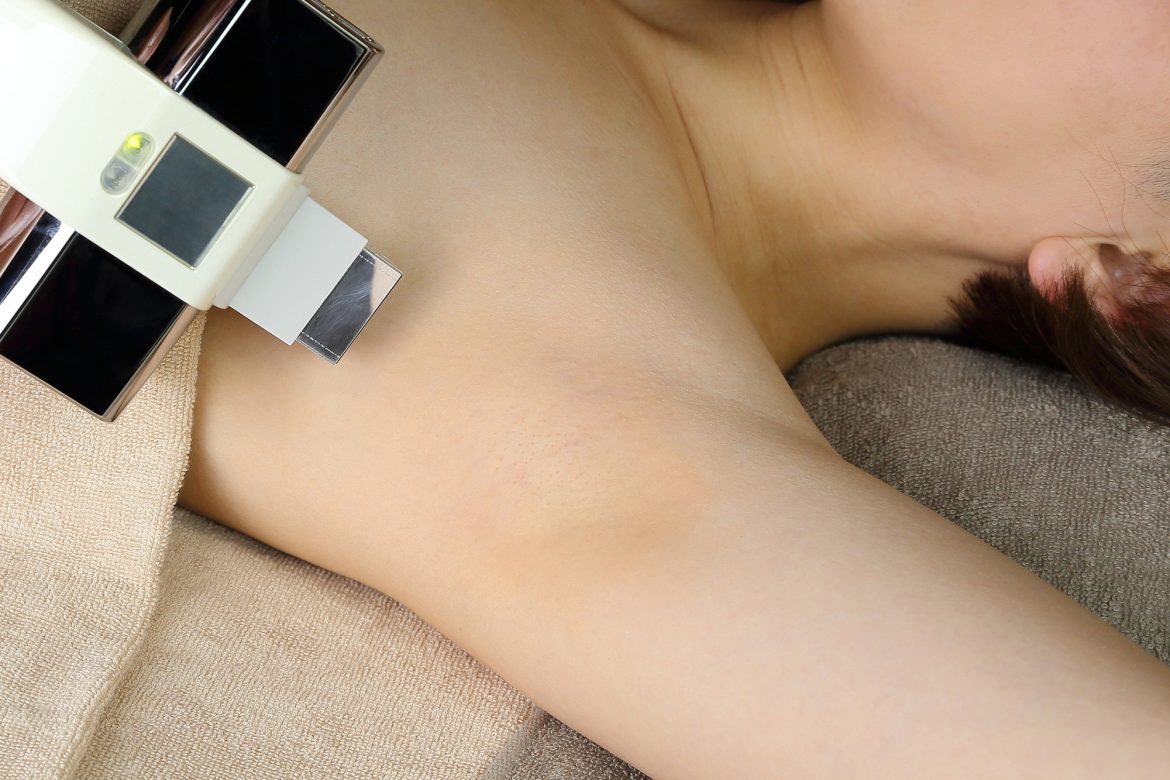 脱毛で脇汗が増えるなんてウソ！汗の仕組みと脱毛のうれしい効果を紹介メンズ脱毛百科事典 リンクスペディア