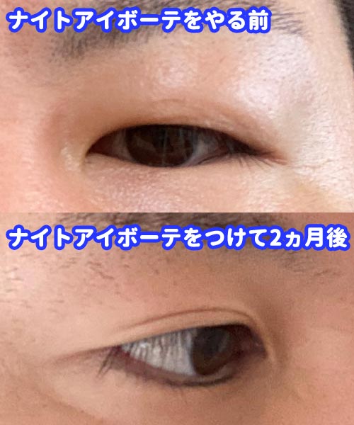 冗談抜きで本当に聞きたいです。ナイトアイボーテって本当に二重に- Yahoo!知恵袋