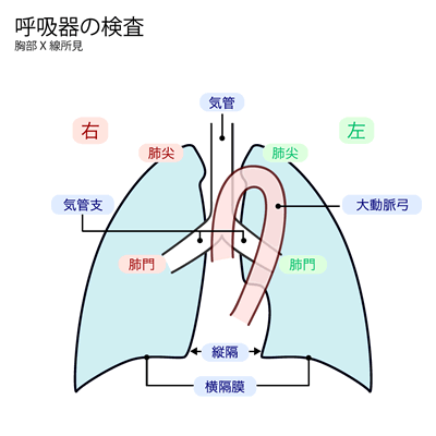 マルファン症候群血管外科心臓血管外科部門診療科・部門のご案内国立循環器病研究センター 病院