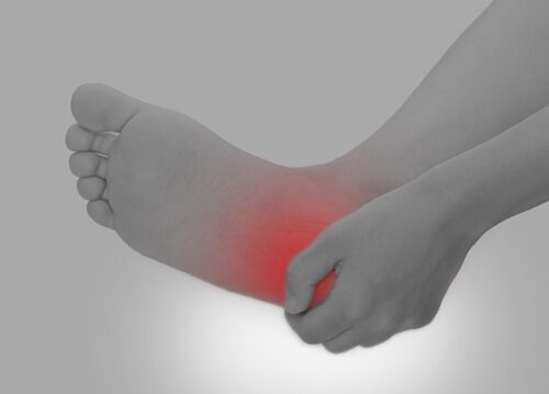 かかとの後ろが痛いのは痛風のせい？どんな痛み？病院は何科？医師監修Medicalook メディカルック