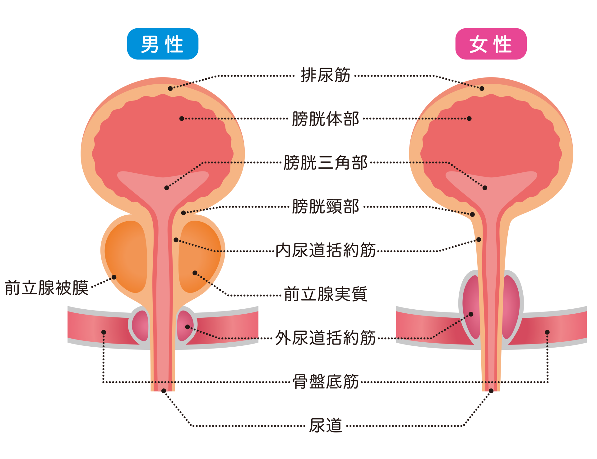 尿道カテーテルQ&A「おさらいしたい！尿道カテーテル挿入時・留置中の “感染対策上”の注意点は？」│看護師ライフをもっとステキに ナースプラス