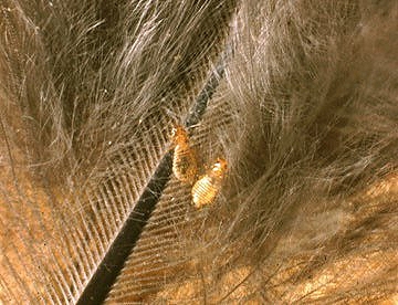 湿疹の痒みが引きません。内臓が悪いのですか？ 4ページ目 ：日経メディカル