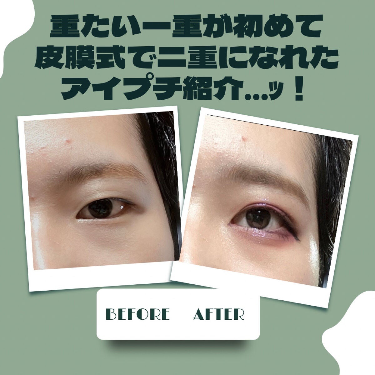 比較検証 絶対二重にならない一重にもおすすめなアイプチ® はあの定番アイテムだった 一重・奥二重のお悩み解決！ 美容メディアVOCE ヴォーチェ