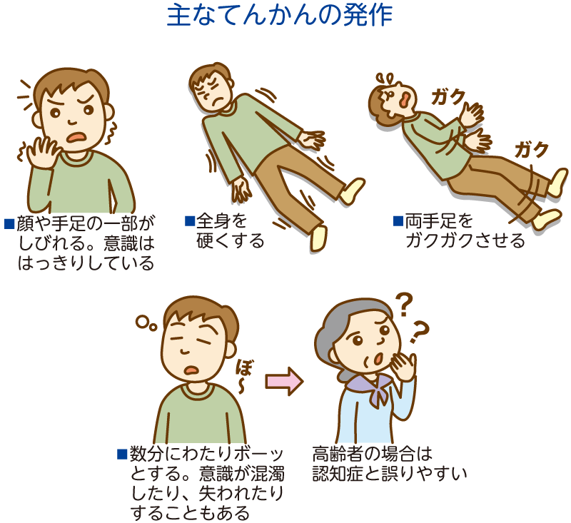 顔面神経麻痺病気と治療の検索サイト「メディカルブレイン」