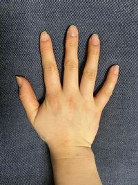 強迫性障害 強迫神経症 の症状・診断・治療について - 田町三田こころみクリニック 内科・心療内科・糖尿病内科・精神科