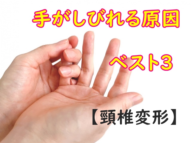 手・腕・肘が痛い方へ札幌市中央区のいとう整形外科病院