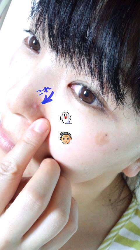 鼻 細かいプツプツ - 何回もこの質問をさせていただいている Q&A - @cosme アットコスメ