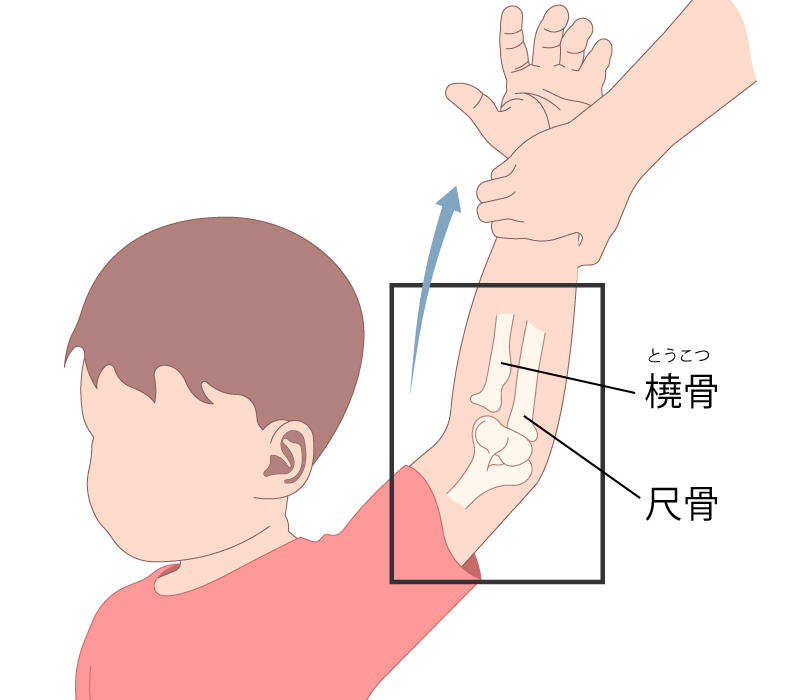 肘や肘から下の腕が痛い原因と予防│天王寺整形外科クリニックＮ