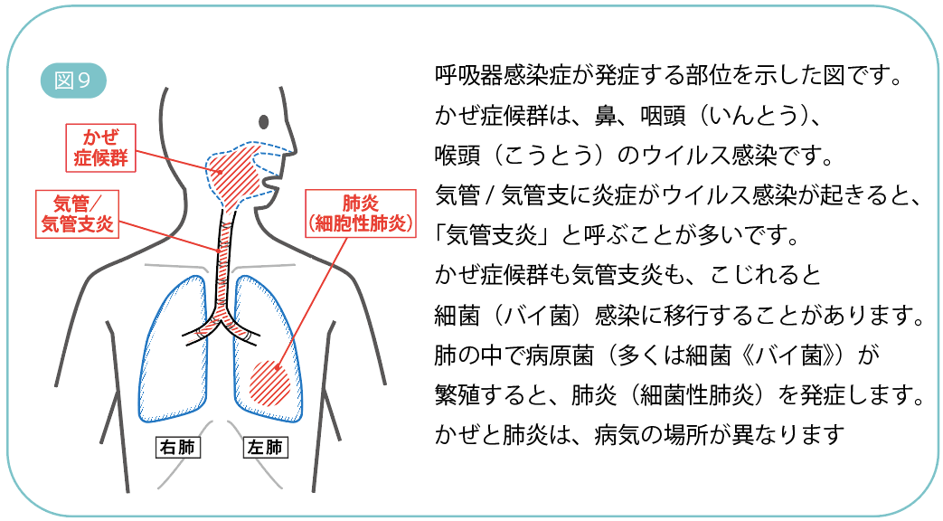 医師監修・作成 気胸とは：原因、症状、検査、治療、再発予防などMEDLEY メドレー