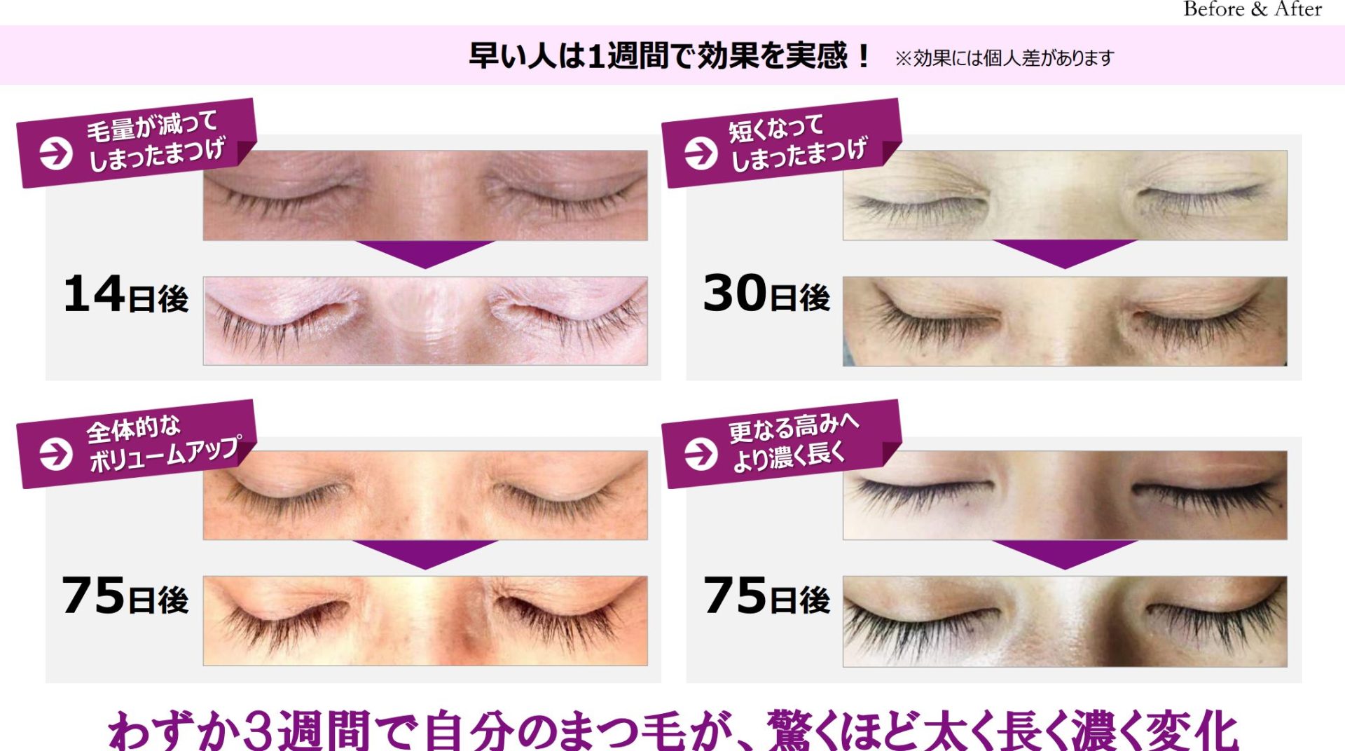 色素沈着しない！まつ毛美容液♡ COSMEbi コスメビコスメ・美容のクチコミ・ランキング