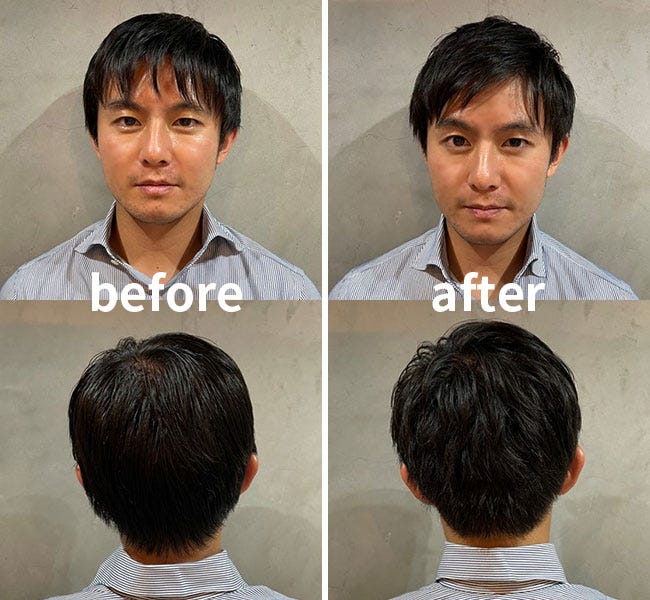 美容師が教える ハゲ隠しにオススメな髪型を薄毛タイプ別に徹底解説！│CAXヘアケア情報サイト