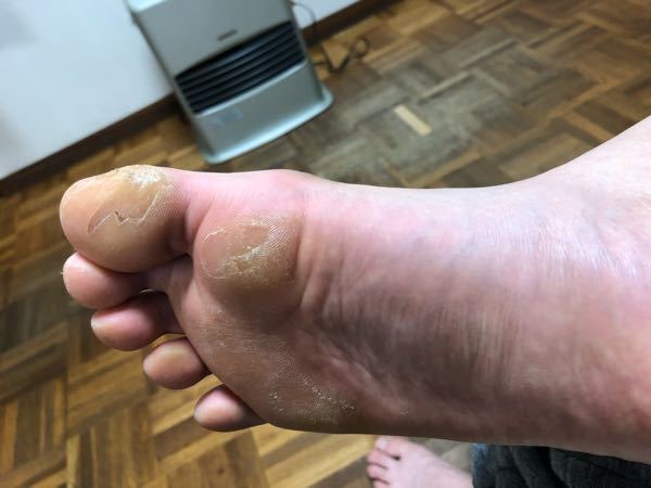 質問日時の新しい順 水虫 解決済みの質問 83ページ目- Yahoo!知恵袋