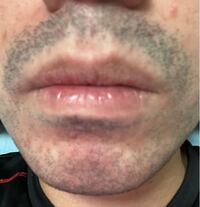 女性のヒゲ脱毛も承ります市川市：市川大野の理容室ヘアー＆フェイシャル Lien リアン