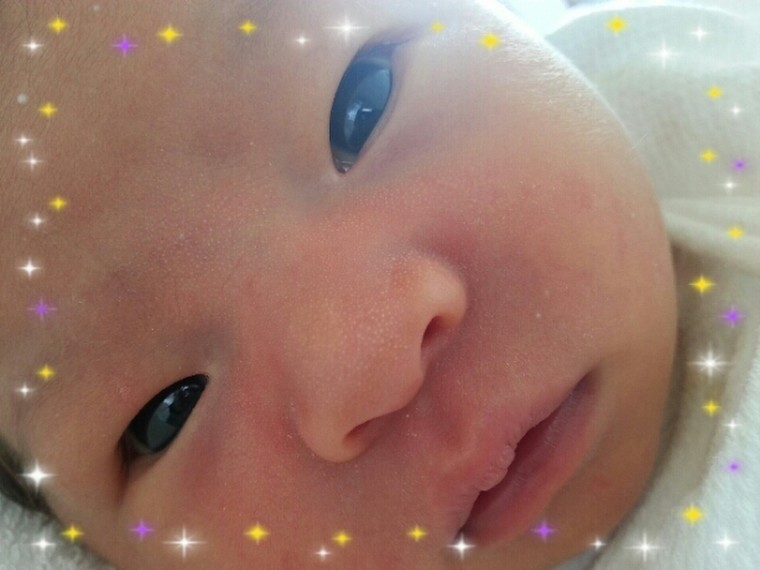 育児記録 退院後の黄疸の経過＠三豊総合病院 - ようおまいりでした